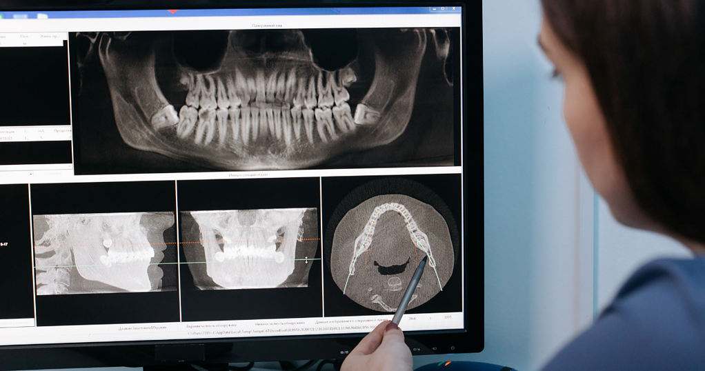 right tools for dental team 