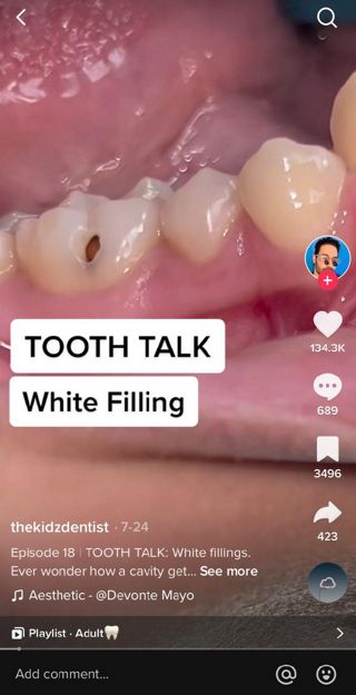 dental tiktok ads