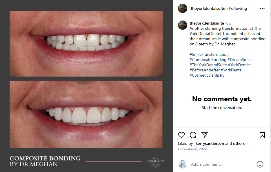 Instagram content ideas for dentists